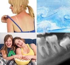 Four images: A person lifts their swimsuit strap to show sunburned shoulders. Blue watercolor painting of curling and foaming waves. Two teens on a sofa with a bowl of popcorn. X-ray of teeth.
