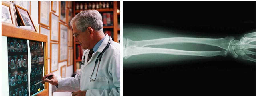 Two photos: (left) a man looks at a series of MRI results mounted on a wall light box. (right) An x-ray image shows forearm, wrist and finger bones.