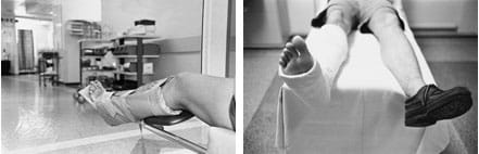Two photos: (left) A lower leg is kept rigid in a splint. (right) A man laying on a gurney with one leg in a cast from below his knee to his toes. 