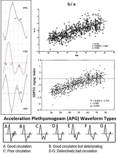 An image identifying PPG, VPG, and APG pulses and the statistical analysis that gave formulas to quantify the arterial stiffness, vascular aging indexes, as well as vascular age. 