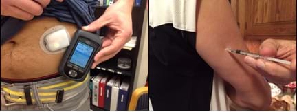 Two photographs: A person uses a pump for insulin administration (looks like a small device adhered to his belly plus a handheld controller device with monitor screen and push buttons) and another person receiving a shot in the back of an arm.