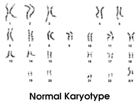 An illustration shows 46 chromosomes numbered and organized into 23 homologous pairs.