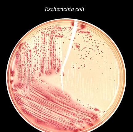 A macro image shows petri dish containing Escherichia coli (E. coli) bacteria