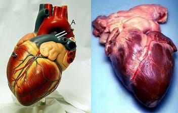 Two photos: A model human heart. A real human heart from an autopsy.