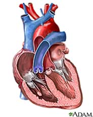 A cutaway drawing of the human heart with the chambers exposed.