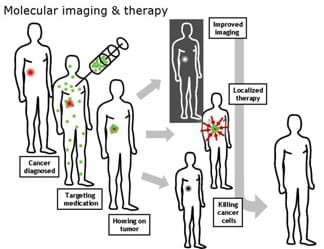 A schematic shows how nanoparticles or other cancer drugs might be used to treat cancer: cancer diagnosed, targeting medication, homing on tumor for improved imaging, localized therapy and killing cancer cells.