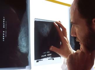 A man examines black and white mammogram films on a wall-mounted light box, looking for signs of breast cancer.