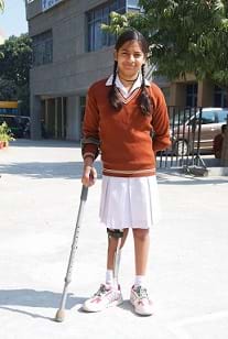 A young girl with polio using a crutch.