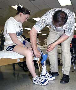 Photograph shows a man adjusting a young woman's lower leg prosthetic.