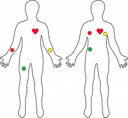 A figure showing outlines of human bodies with marked locations for typical sensor placements. A figure showing outlines of human bodies with marked locations for typical sensor placements.