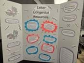 A photo of a student-created trifold poster presentation about Leber Congenital Amaurosis.