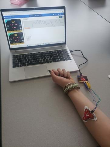 A photo showing a muscle sensor with electrodes placed on a student’s forearm and attached to a micro:bit with wires. On the other end, the micro:bit is attached to a laptop computer showing graphical and numerical EMG data on the micro:bit makecode website.