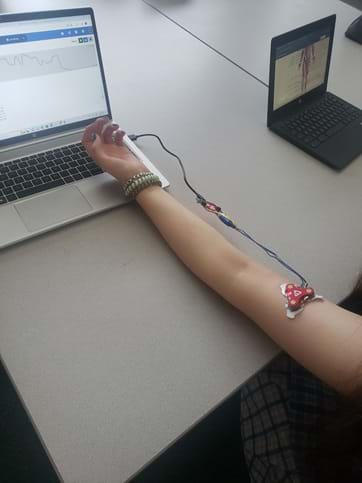 A photo showing a muscle sensor with electrodes placed on a student’s upper arm and attached to a micro:bit with wires. On the other end, the micro:bit is attached to a  laptop computer showing graphical and numerical EMG data on the micro:bit MakeCode website.