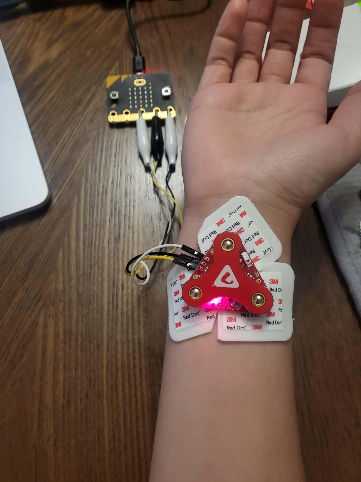 A photo showing a muscle sensor with electrodes attached right under the wrist and the clip alligators attached from the muscle sensor to the micro:bit A photo showing a muscle sensor with electrodes attached right under the wrist and the clip alligators attached from the muscle sensor to the micro:bit